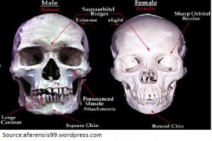 Picture showing the difference between male and famle supraorbital ridge