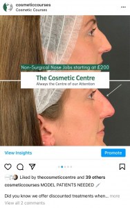 TOP 10 MOST INSTAGRAMMED TREATMENTS NON SURGICAL RHINOPLASTY