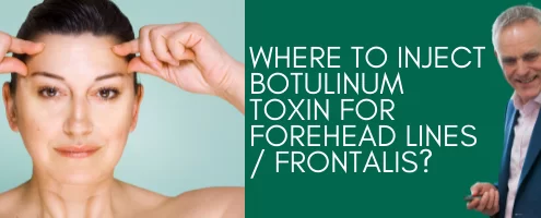 Where can I inject botox for forehead lines cosmetic courses