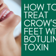How to Treat Crow's Feet with Botulinum Toxin (1)