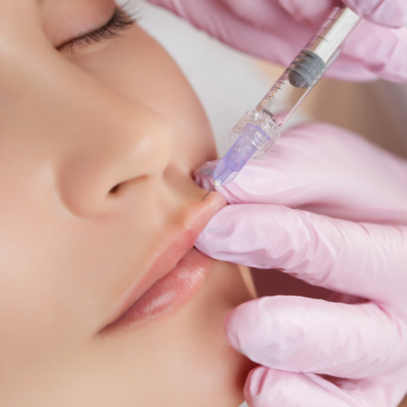 Introduction to Lip Filler Training Online